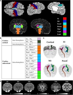 Early structural connectivity within the sensorimotor network: Deviations related to prematurity and association to neurodevelopmental outcome